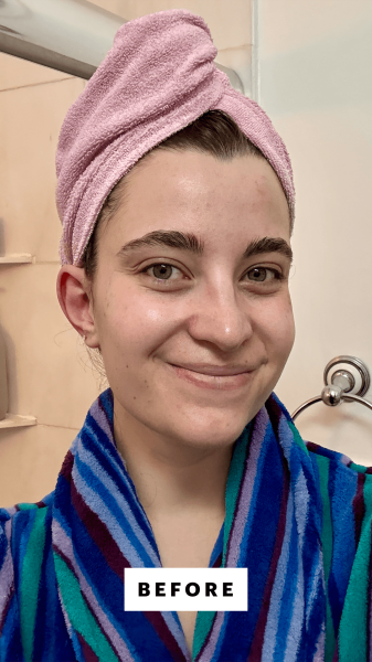 Felbin before applying the Anua PDRN Hyaluronic Acid 100 Moisturizing Cream